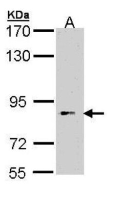 BBS12 Antibody, Novus Biologicals 0.1mg; Unlabeled:Antibodies, Polyclonal