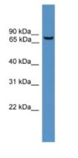 BBS2 Antibody, Novus Biologicals 100&mu;L; Unlabeled:Antibodies, Polyclonal