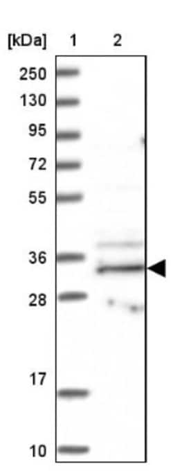 BBS4 Antibody, Novus Biologicals:Antibodies:Primary Antibodies