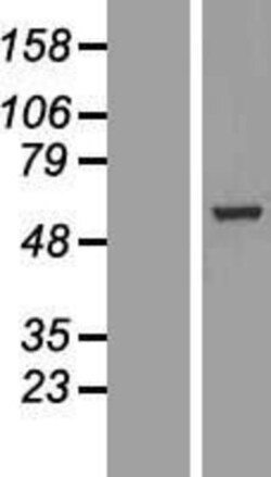 Novus Biologicals&trade;&nbsp;BBS4 Overexpression Lysate