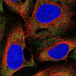 BBS4 Antibody, Novus Biologicals 25 &mu;L; Unlabeled:Antibodies, Polyclonal