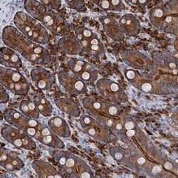 BBS4 Antibody, Novus Biologicals 25 &mu;L; Unlabeled:Antibodies, Polyclonal