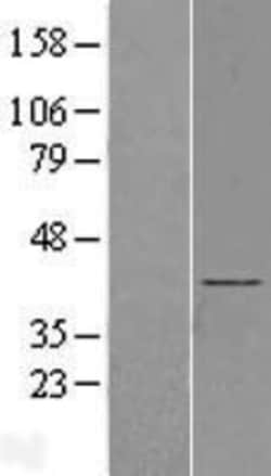 Novus Biologicals™ BBS5 Overexpression Lysate