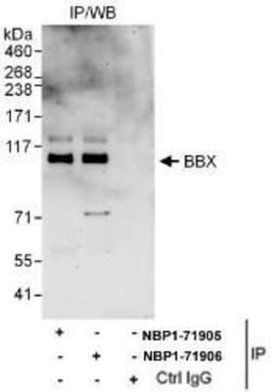 BBX Antibody, Novus Biologicals 0.1mg; Unlabeled:Antibodies, Polyclonal