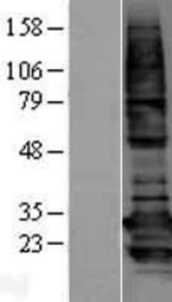 Novus Biologicals&trade;&nbsp;BCAP31 Overexpression Lysate