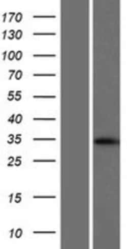 Novus Biologicals&trade;&nbsp;BCAP31 Overexpression Lysate