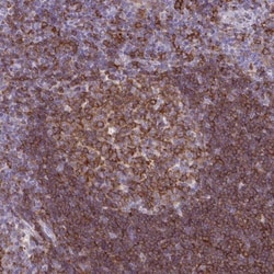 BCAP/PIK3AP1 Antibody, Novus Biologicals 0.1mL; Unlabeled:Antibodies, Polyclonal