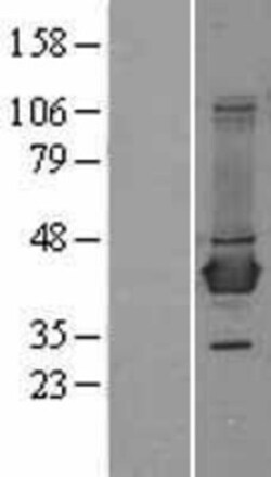 Novus Biologicals™ BCAT1 Overexpression Lysate