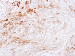 BCAT2 Antibody, Novus Biologicals 0.1mg; Unlabeled:Antibodies, Polyclonal
