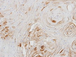 BCAT2 Antibody, Novus Biologicals 0.1mg; Unlabeled:Antibodies, Polyclonal