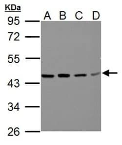 BCAT2 Antibody, Novus Biologicals 0.1mg; Unlabeled:Antibodies, Polyclonal