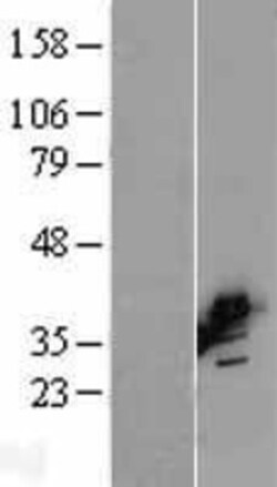 Novus Biologicals™ BCAT2 Overexpression Lysate