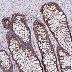 BCAT2 Antibody, Novus Biologicals 0.1mL; Unlabeled:Antibodies, Polyclonal