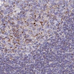 BCAT2 Antibody, Novus Biologicals 0.1mL; Unlabeled:Antibodies, Polyclonal