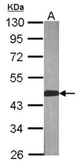 BCAT2 Antibody, Novus Biologicals 0.1mg; Unlabeled:Antibodies, Polyclonal