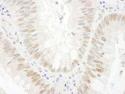 BCCIP Antibody, Novus Biologicals 0.1mg; Unlabeled:Antibodies, Polyclonal