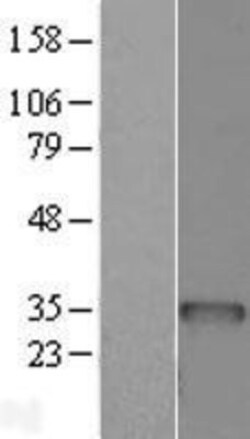 Novus Biologicals™ BCDIN3D Overexpression Lysate