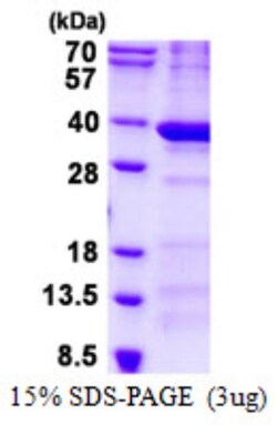 Novus Biologicals&trade;&nbsp;Recombinant Human BCDIN3D His Protein