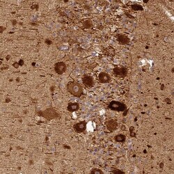 BCDIN3D Antibody, Novus Biologicals 0.1mL; Unlabeled:Antibodies, Polyclonal