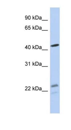 BCKDHA Antibody, Novus Biologicals 0.05mg; Unlabeled:Antibodies, Polyclonal