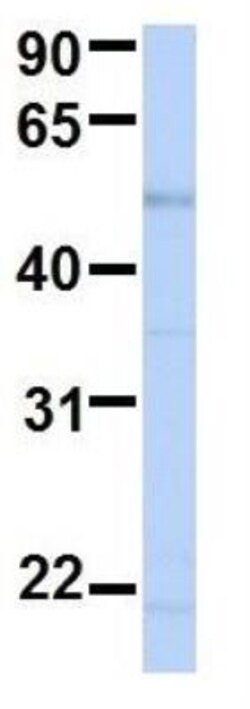 BCKDHA Antibody, Novus Biologicals 0.05mg; Unlabeled:Antibodies, Polyclonal
