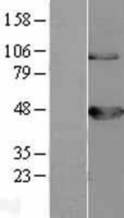 Novus Biologicals™ BCKDK Overexpression Lysate