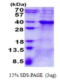 Novus Biologicals&trade;&nbsp;Recombinant Human Bcl 7A His Protein