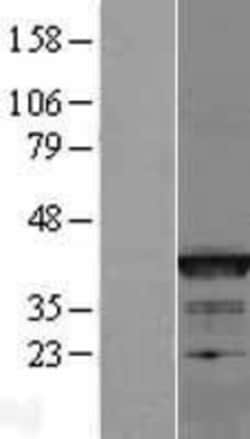 Novus Biologicals&trade;&nbsp;Bcl G Overexpression Lysate