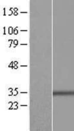 Novus Biologicals™ Bcl G Overexpression Lysate