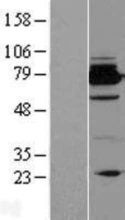 Novus Biologicals&trade;&nbsp;Bcl rambo Overexpression Lysate