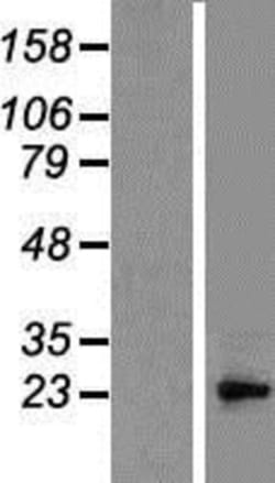 Novus Biologicals™ Bcl-10 Overexpression Lysate