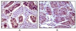 Bcl-10 Antibody (4F8) - BSA Free, Novus Biologicals 0.1mg; Unlabeled:Antibodies,
