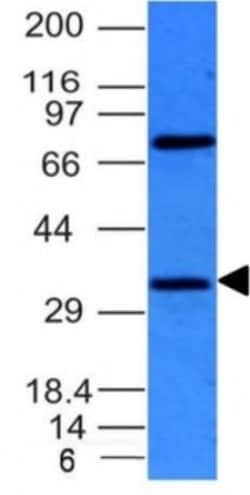 Bcl-10 Antibody (BL10/411), Novus Biologicals:Antibodies:Primary Antibodies