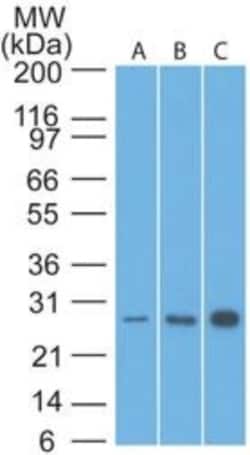 Bcl-2 Antibody (8C8), Novus Biologicals 0.1mg; Unlabeled:Antibodies, Monoclonal