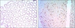 Bcl-2 Antibody (8E12), Novus Biologicals 0.1mL; Unlabeled:Antibodies, Monoclonal