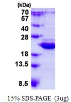 Novus Biologicals&trade;&nbsp;Recombinant Human BCL2L10 His Protein