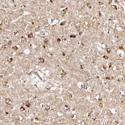 BCL2L15 Antibody, Novus Biologicals 25 &mu;L; Unlabeled:Antibodies, Polyclonal