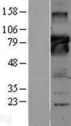 Novus Biologicals&trade;&nbsp;Bcl-6 Overexpression Lysate