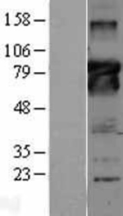Novus Biologicals Bcl-6 Overexpression Lysate 0.1mg | Buy Online | Novus Biologicals&trade; | Fisher Scientific