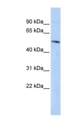 BCL6B Antibody, Novus Biologicals 0.05mg; Unlabeled:Antibodies, Polyclonal