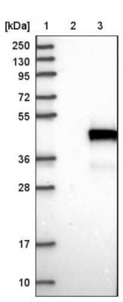 Bcl 7A Antibody, Novus Biologicals 25 &mu;L; Unlabeled:Antibodies, Polyclonal