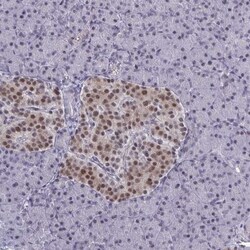 BCL7B Antibody, Novus Biologicals 25 &mu;L, Unlabeled:Antibodies, Polyclonal