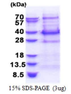 Novus Biologicals&trade;&nbsp;Recombinant Human BCL7C His Protein