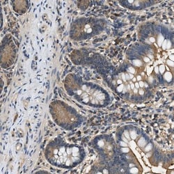 delta-Sarcoglycan Antibody, Novus Biologicals:Antibodies:Primary Antibodies