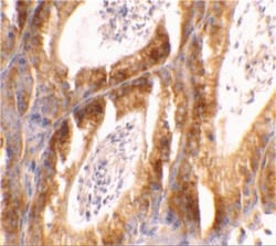 Bcl G Antibody, Novus Biologicals 0.1mg; Unlabeled:Antibodies, Polyclonal