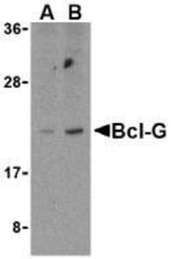 Bcl G Antibody, Novus Biologicals 0.1mg; Unlabeled:Antibodies, Polyclonal