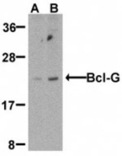 Bcl G Antibody, Novus Biologicals 0.1mg; Unlabeled:Antibodies, Polyclonal