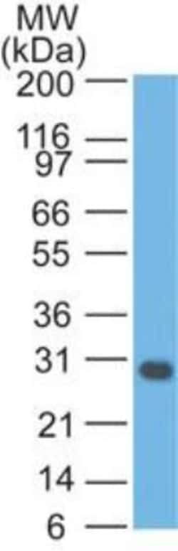 bcl-x Antibody (BX006), Novus Biologicals 0.1mg; Unlabeled:Antibodies,
