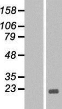 Novus Biologicals&trade;&nbsp;Bcl-xL Overexpression Lysate