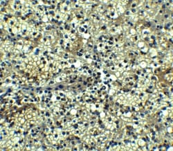 BCMA/TNFRSF17 Antibody - BSA Free, Novus Biologicals 0.1mg; Unlabeled:Antibodies,